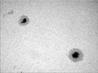 � M. Neuerer; Sonne am 17.07.2001 - Die Aufnahmen sind mit einem 180er TMB Apo (abgeblendet auf 140 mm / schlechtes seeing) gemacht. Als Kamera diente eine Nikon Coolpix 880 Digitalkamera mit 6 mm LV Okular.